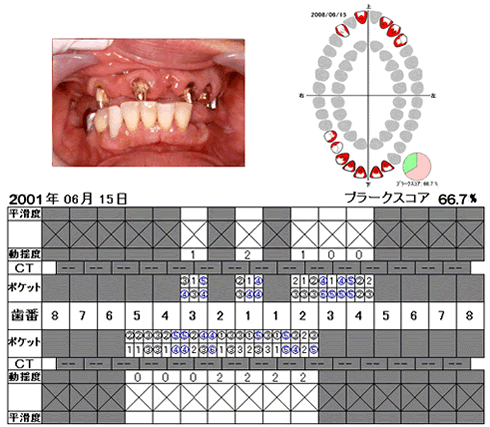 口腔写真と検査結果