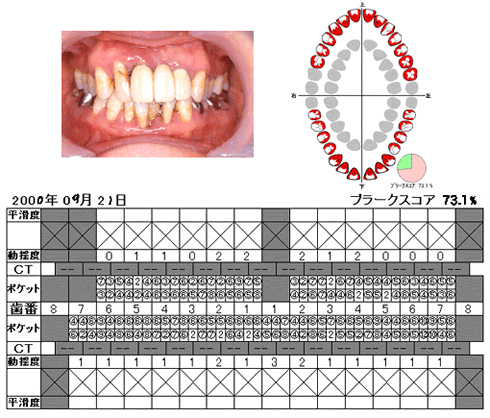 口腔写真と検査結果