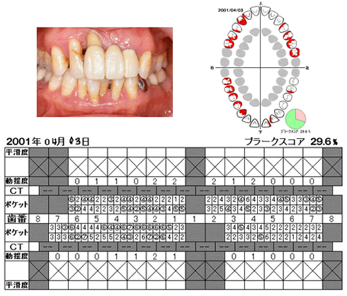 口腔写真と検査結果