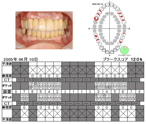 口腔写真と検査結果