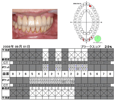 口腔写真と検査結果