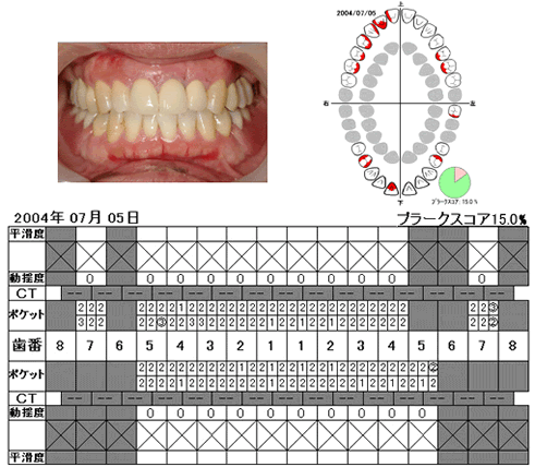 写真と検査結果