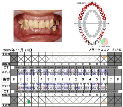 写真と検査結果