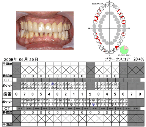 写真と検査結果